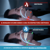 SilentSleep™ Dispositivo Anti Ronquidos